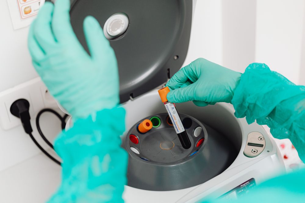 Laboratory testing related to antifungal resistance